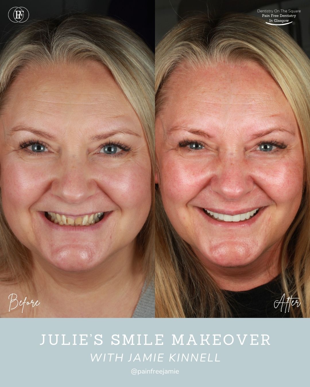 Julie's Smile Story