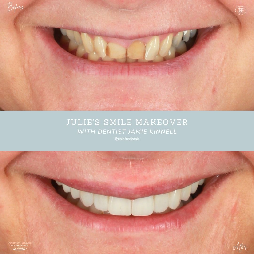 Ross's Smile Story with Andy