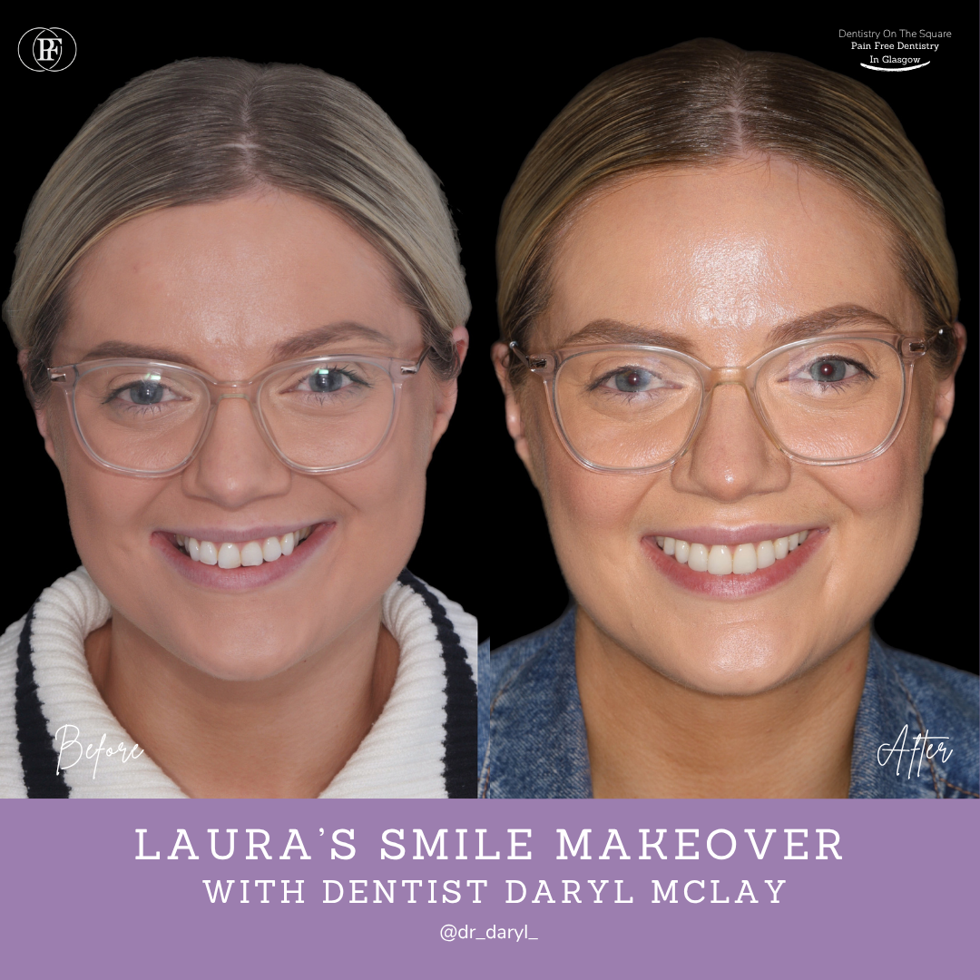 Dentistry On The Square, Pain Free Dentist Glasgow - Laura’s Smile Story