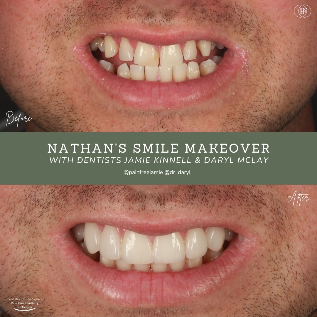 Ross's Smile Story with Andy