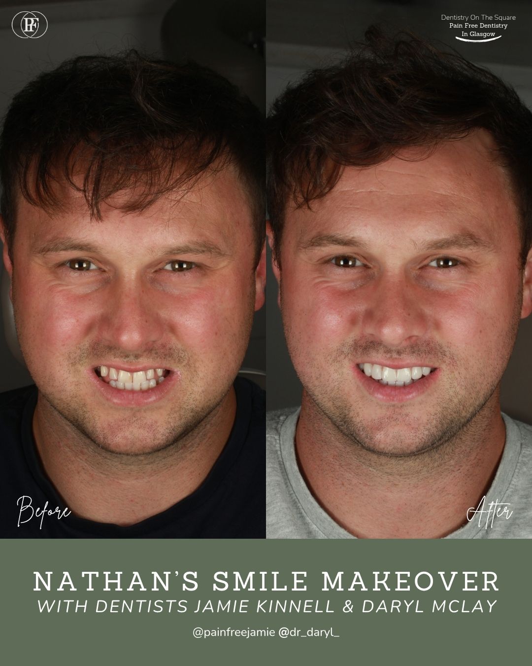 Nathan's Smile Story