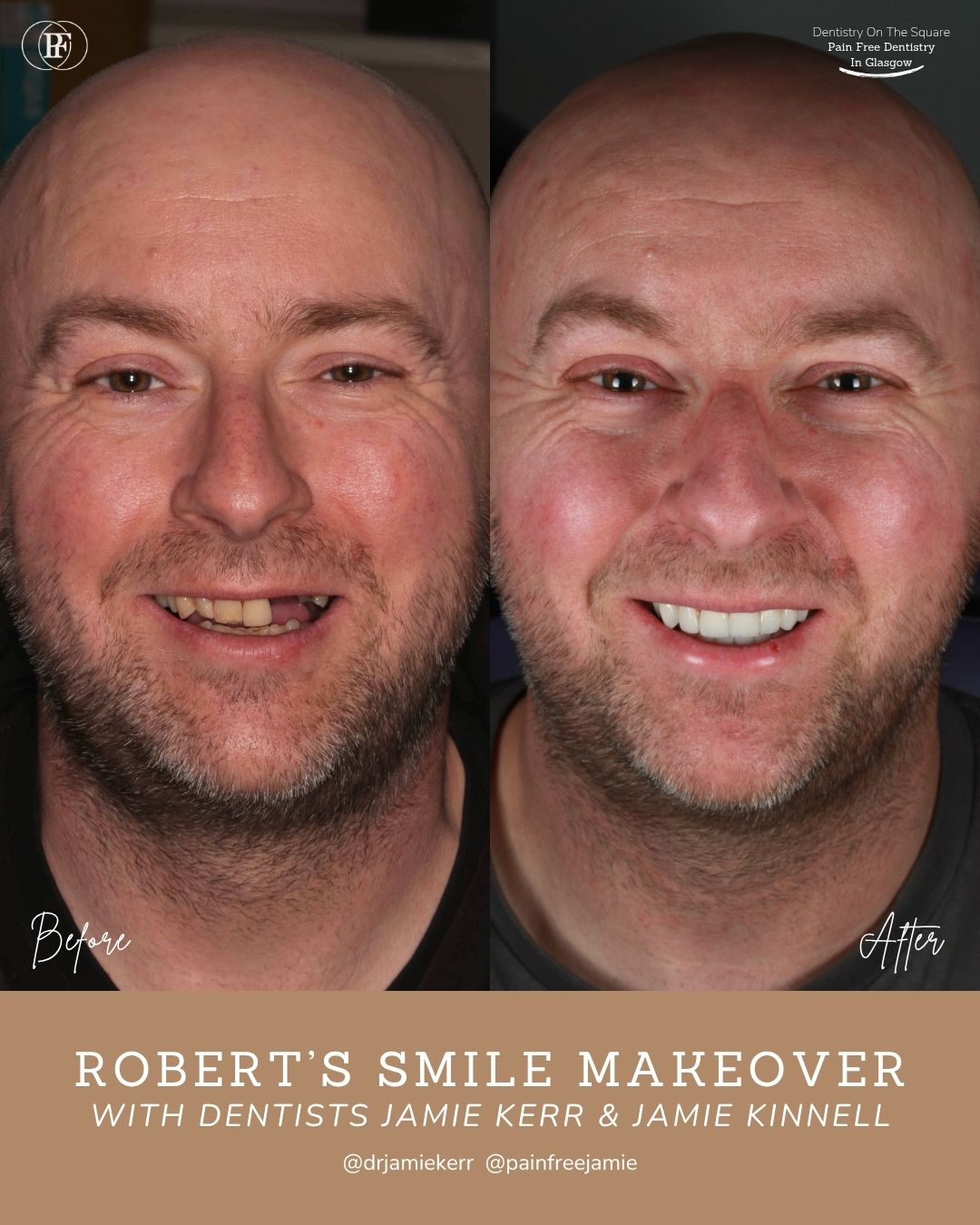 Robert's Smile Story with Jamie Kerr and Jamie Kinnell (1)