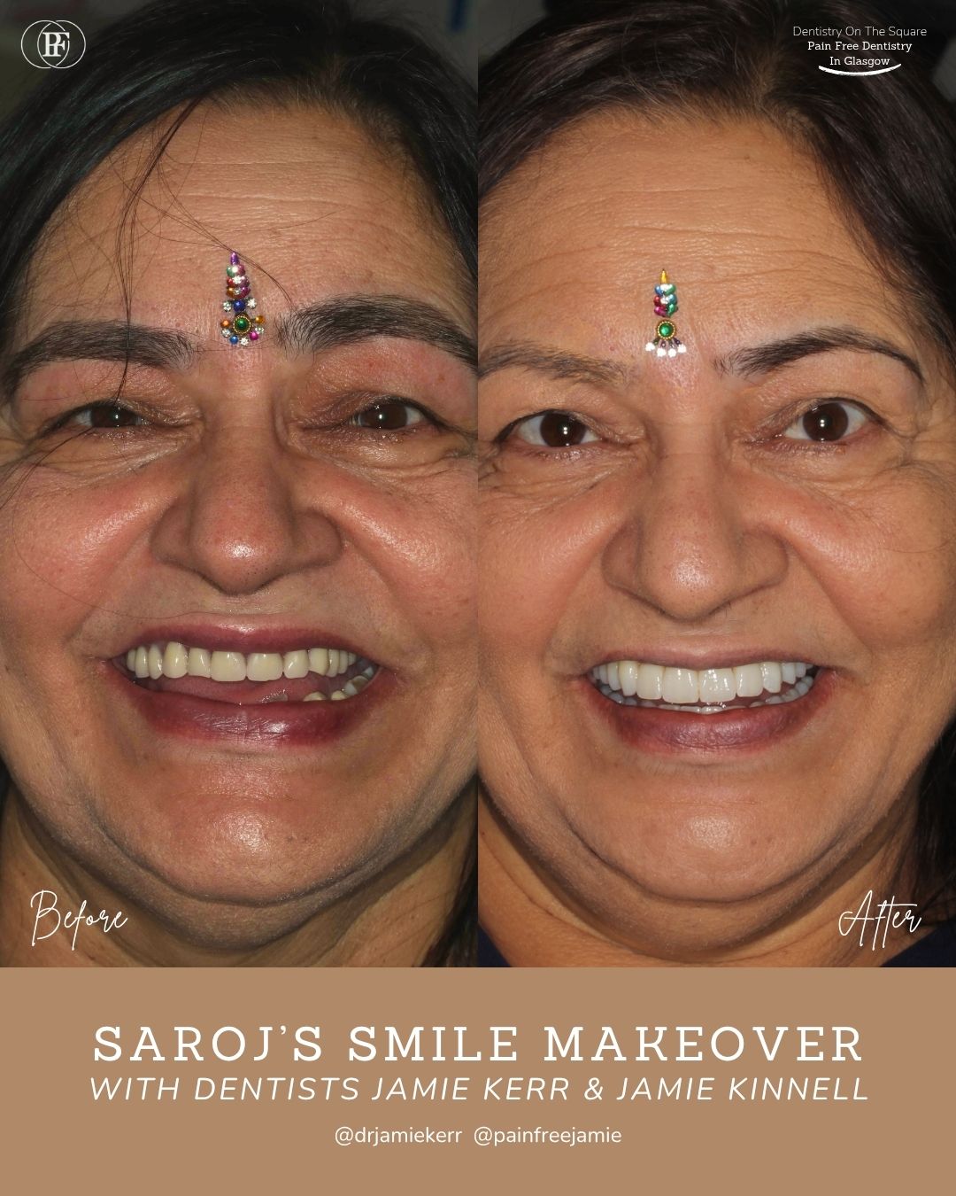 Saroj's Smile Story