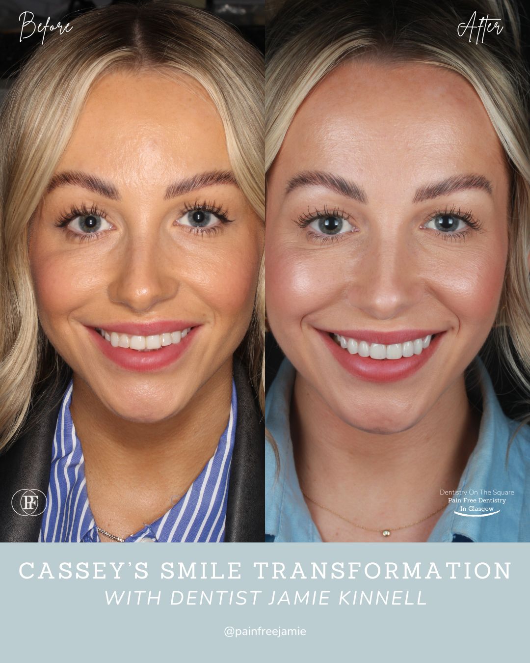 Cassey's Smile Story