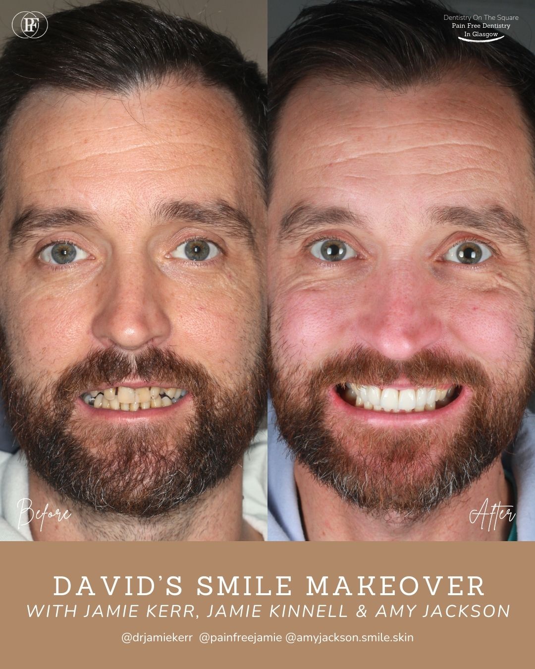 Jodie's Smile Story with Jamie Kerr and Niall Ballock