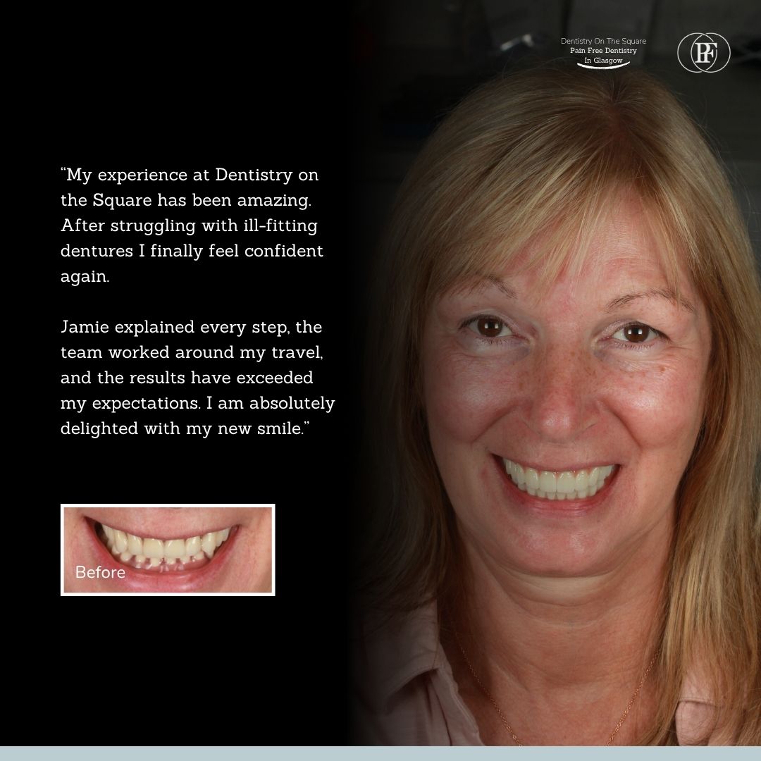 Dentistry On The Square, Pain Free Dentist Glasgow - Elaine’s Smile Story Ross's smile story
