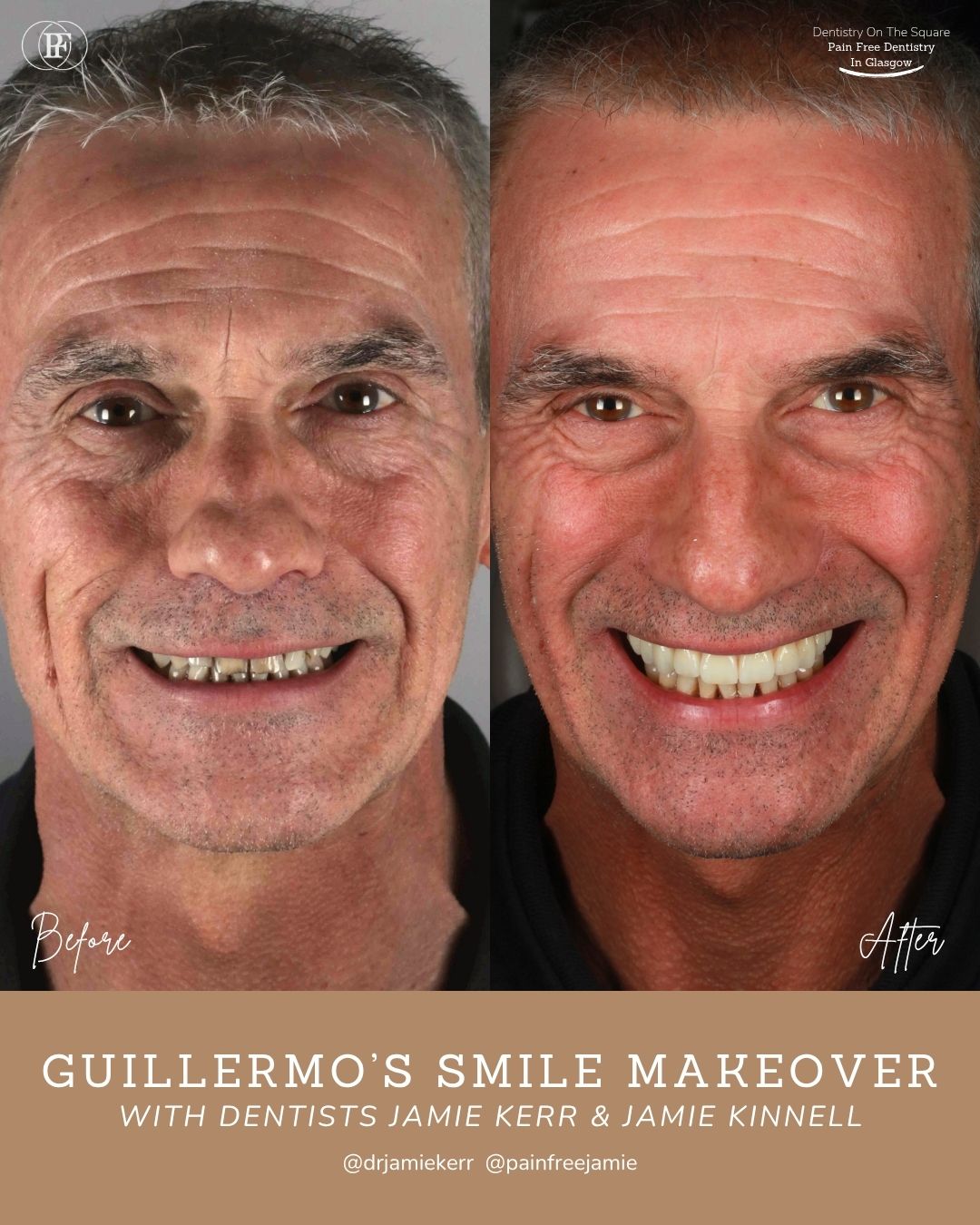 Guillermo's Smile Story with Jamie Kerr and Jamie Kinnell