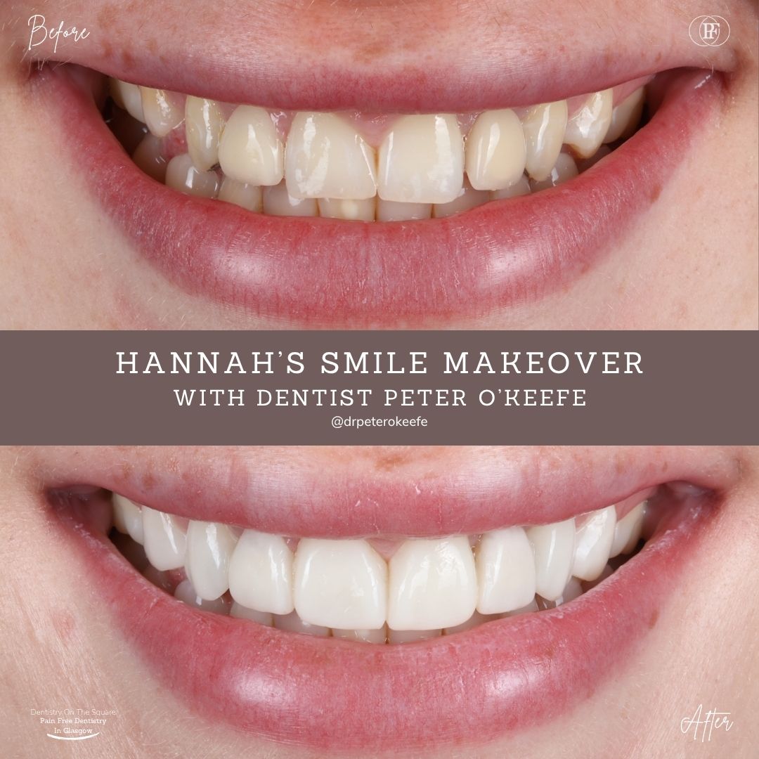 Hannah's Smile Story With Peter DOTS (1080 x 1080 px) (3)