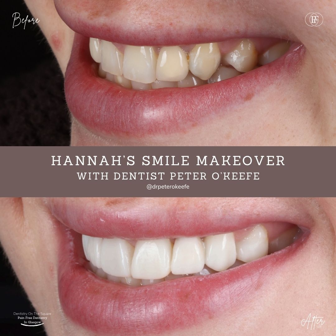 Hannah's Smile Story With Peter DOTS (1080 x 1080 px) (3)