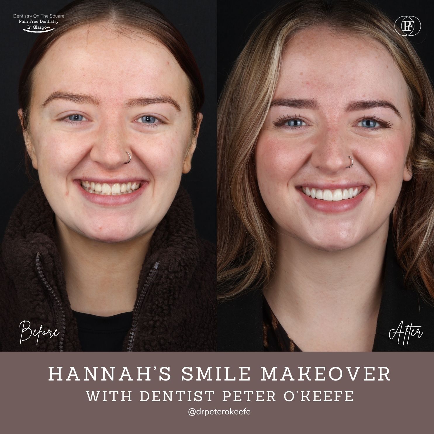 Hannah's Smile Story With Peter DOTS (1080 x 1080 px) (3)
