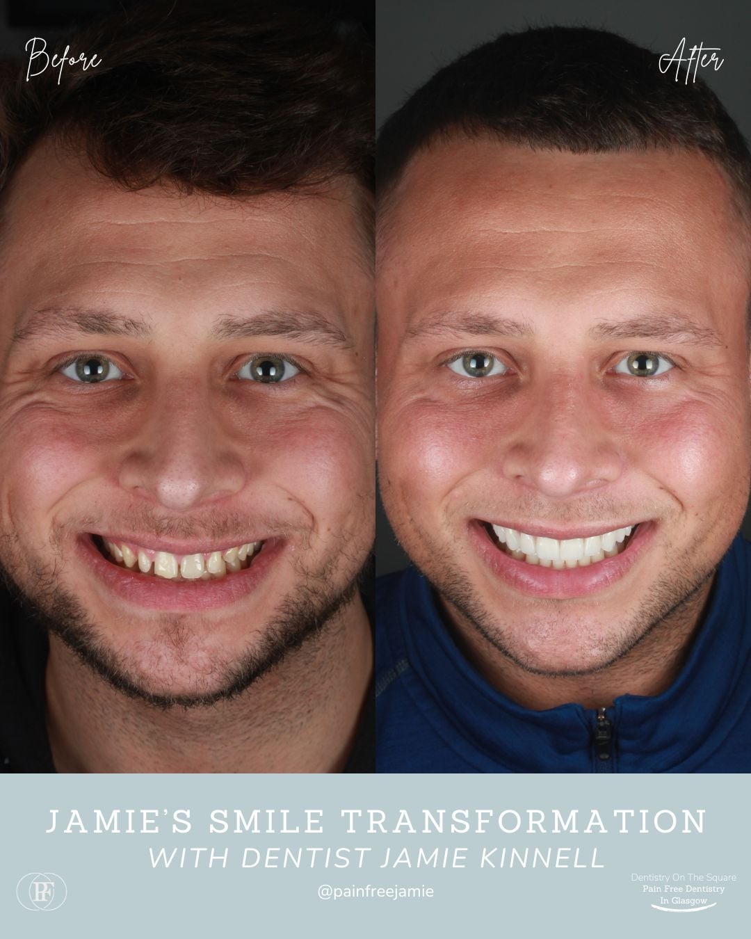 Jamie's Smile Story