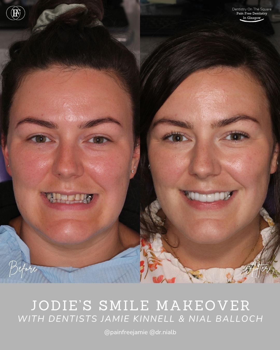 Jodie's Smile Story with Jamie Kerr and Niall Ballock