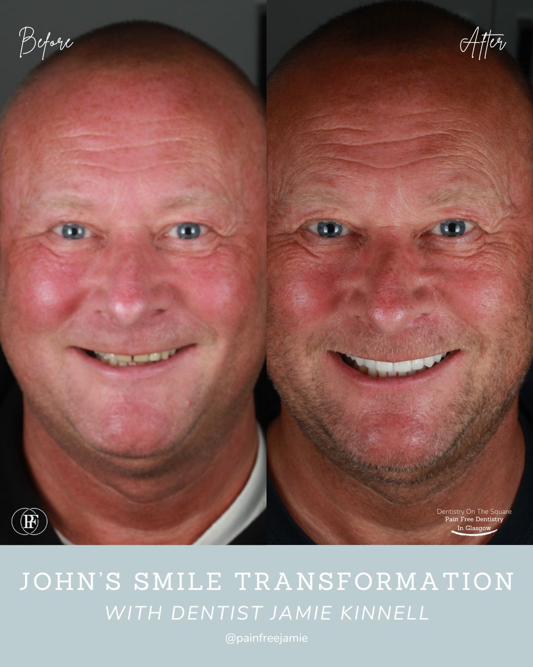 John's Smile Story