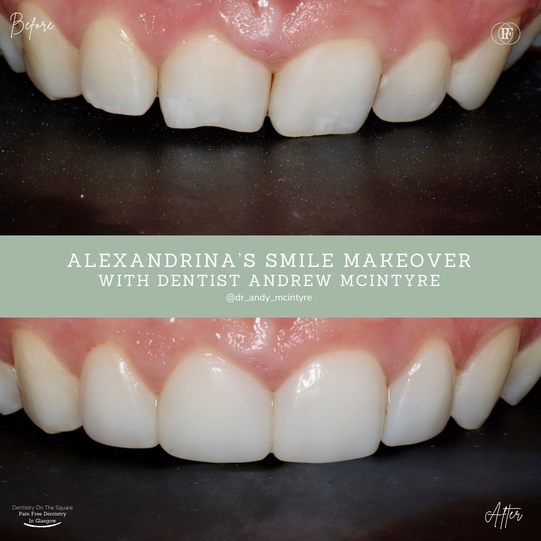 Dentistry On The Square, Pain Free Dentist Glasgow - Alexandrina's Smile Story