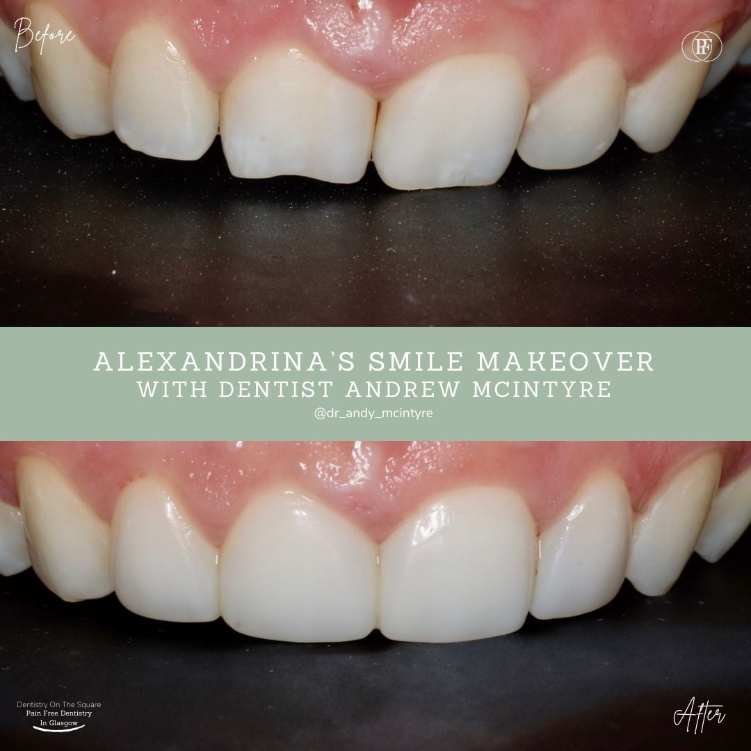 Alexandrina's Smile Story With Andy DOTS