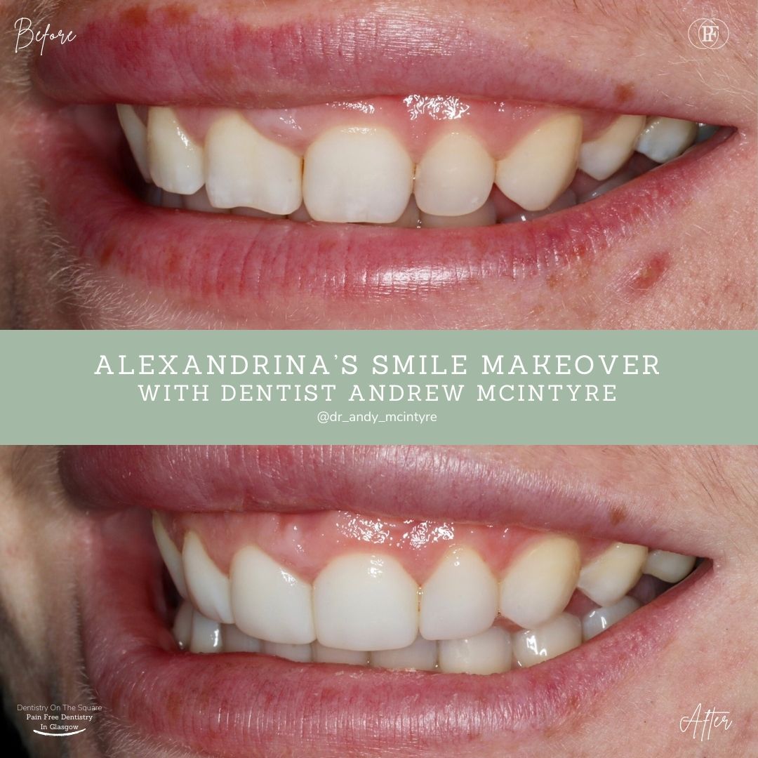 Alexandrina's Smile Story