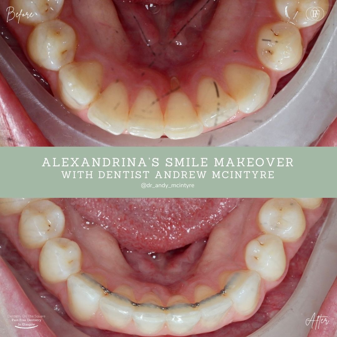 Alexandrina's Smile Story 