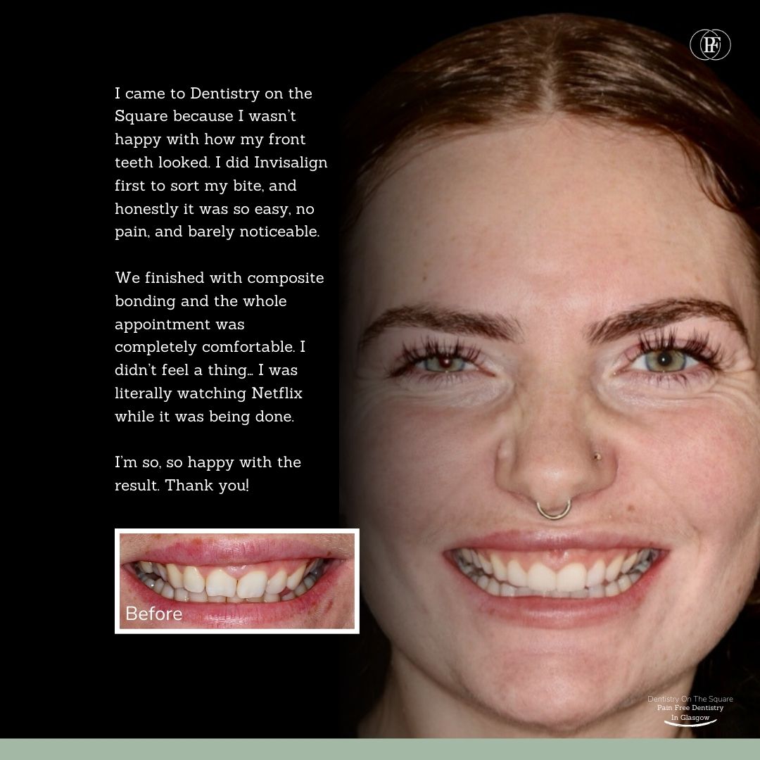Alexandrina's Smile Story 