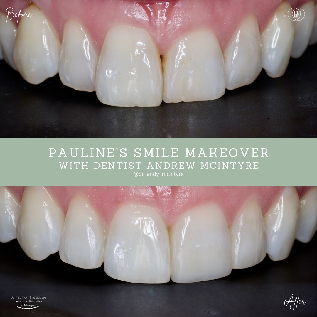 Pauline's Smile Story