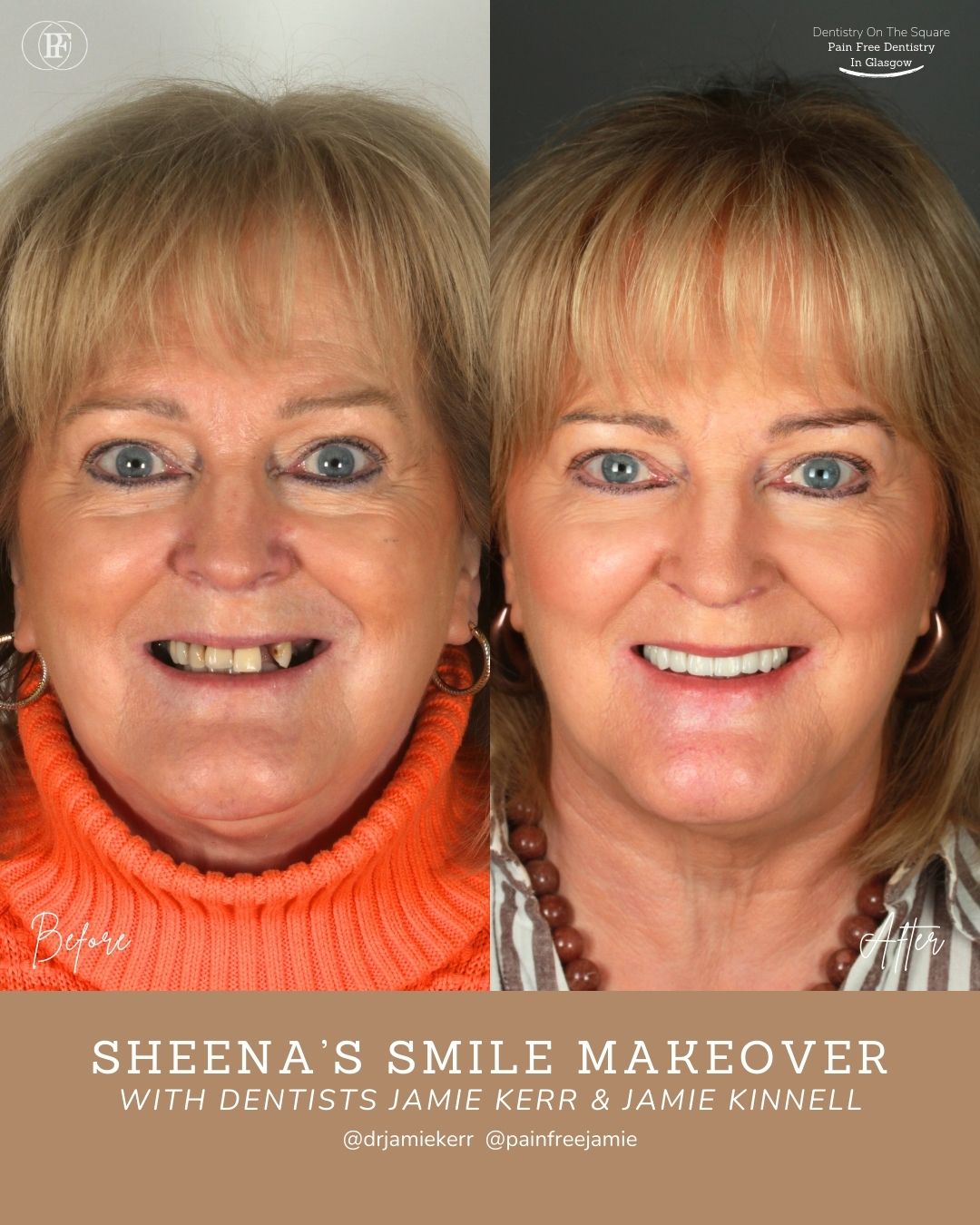 Sheena's Smile Story