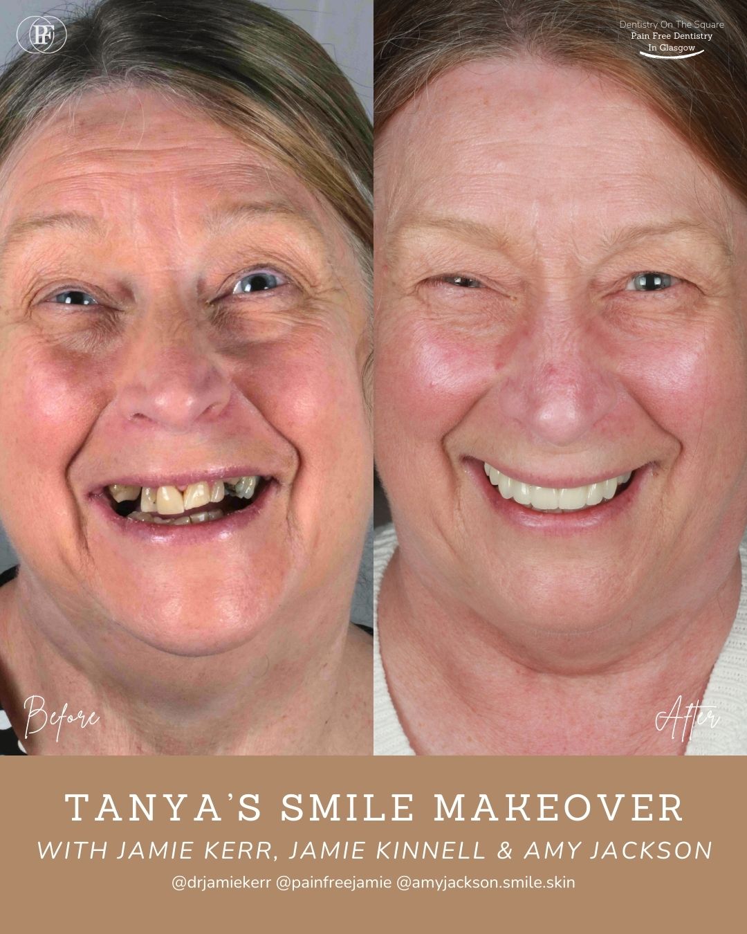 Tanya's Smile Story with Jamie Kerr and Niall Ballock