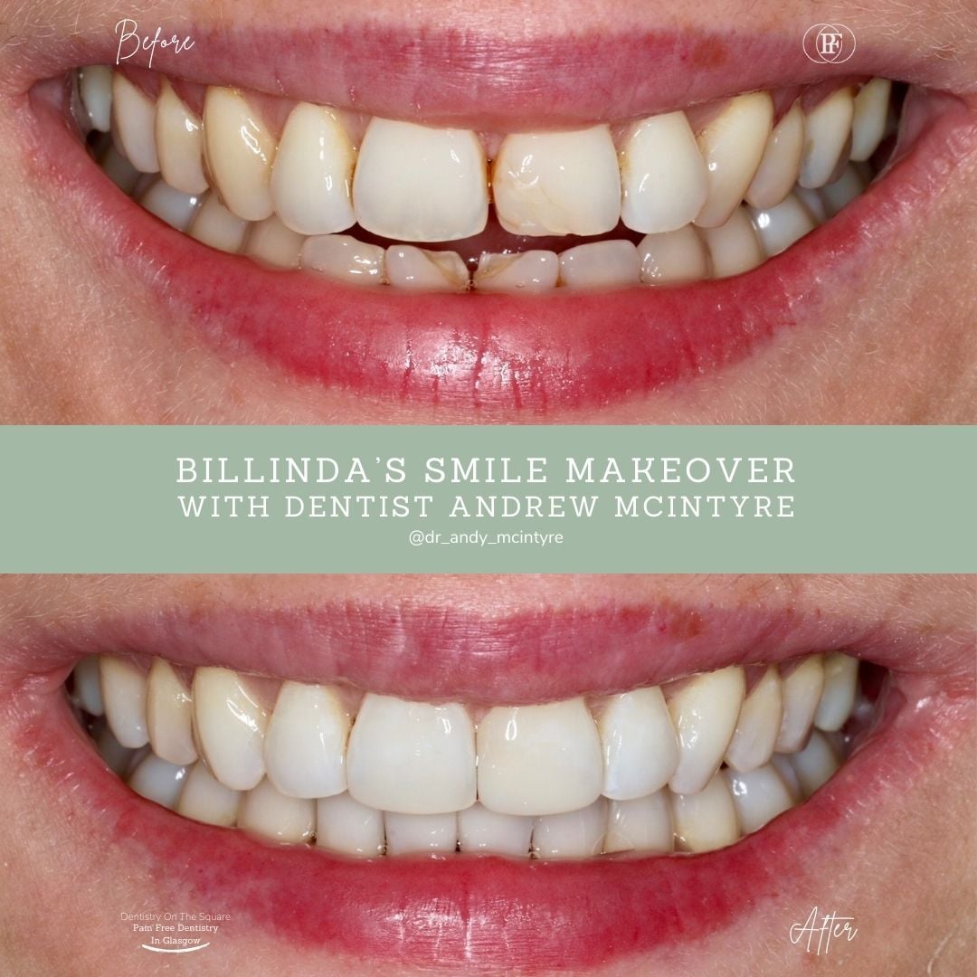 Billinda's Smile Story With Andy DOTS 