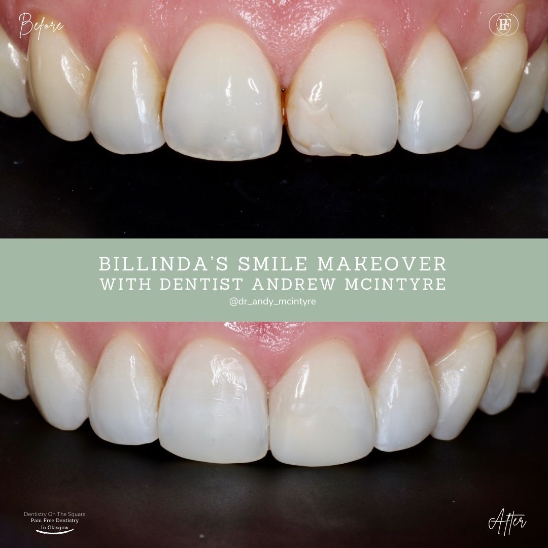 Billinda's Smile Story With Andy DOTS 