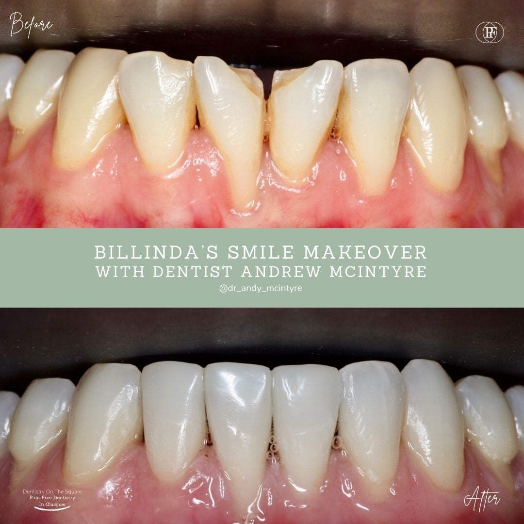 Billinda's Smile Story With Andy DOTS 