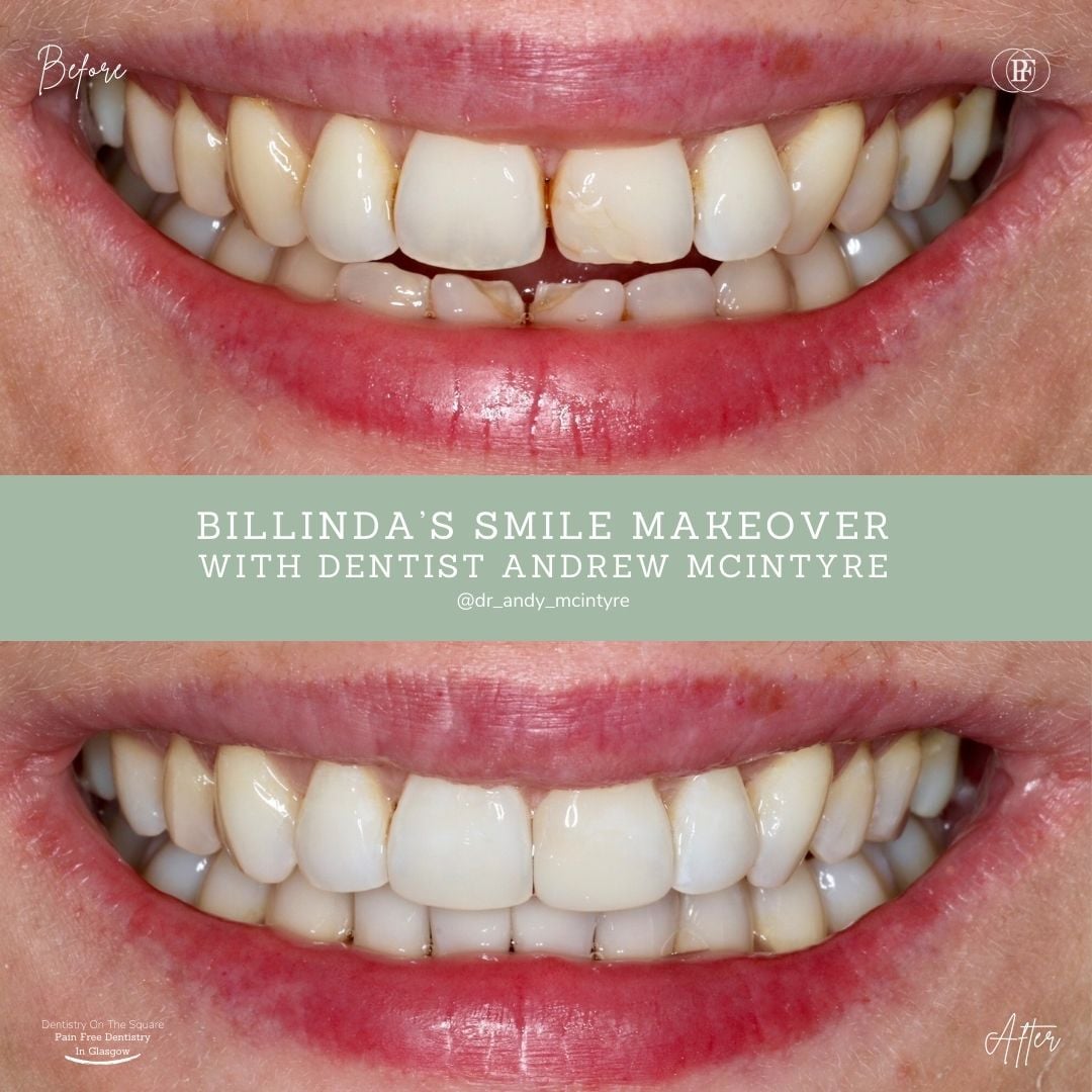 Billinda's Smile Story With Andy DOTS 