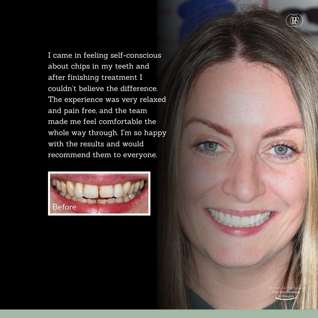 Billinda's Smile Story With Andy DOTS 