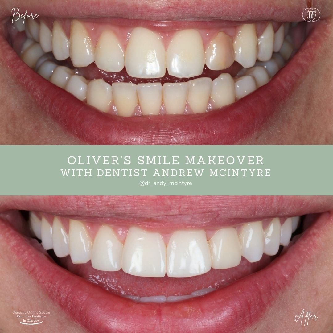 Oliver's Smile Story With Andy DOTS