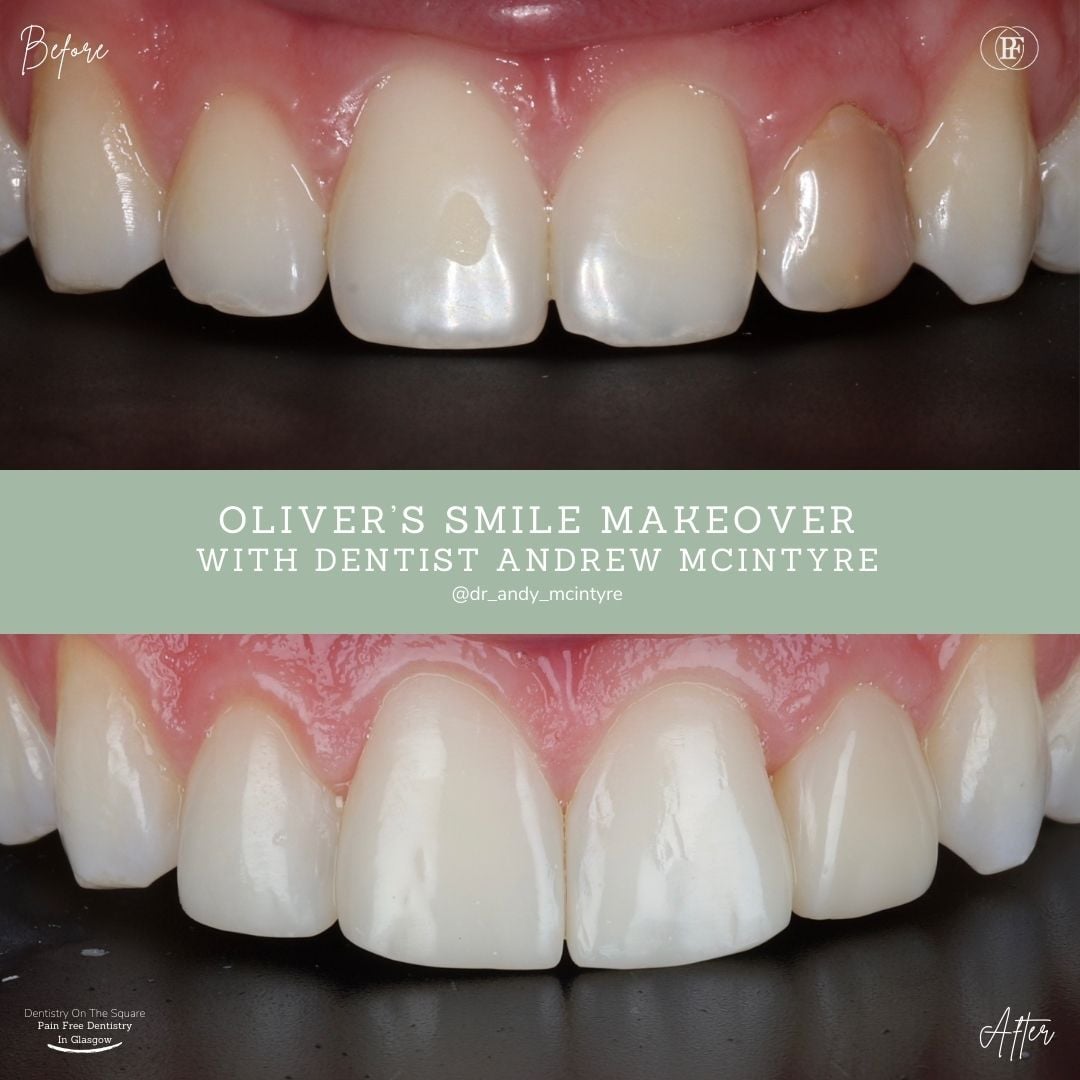 Oliver's Smile Story With Andy DOTS