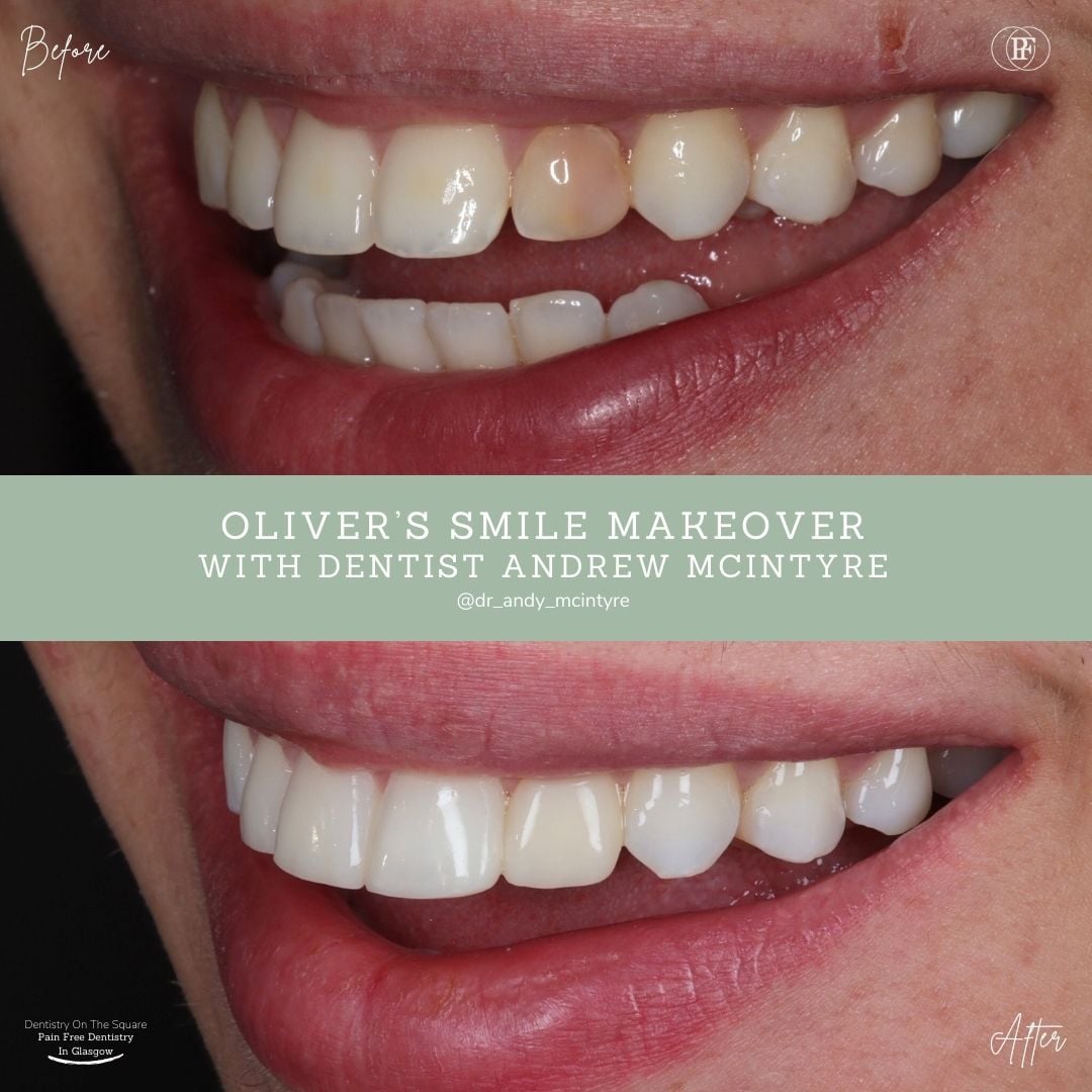Oliver's Smile Story With Andy DOTS