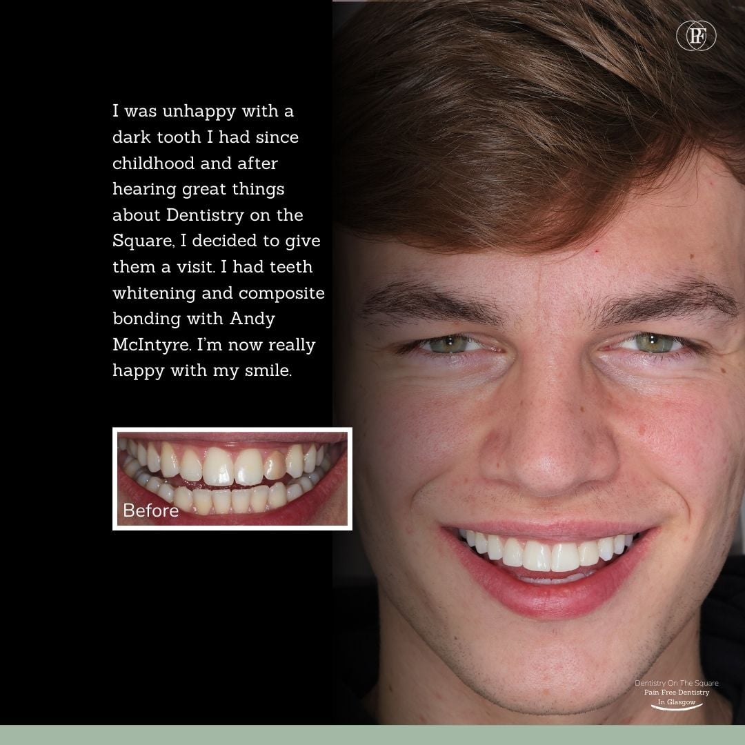 Oliver's Smile Story With Andy DOTS 