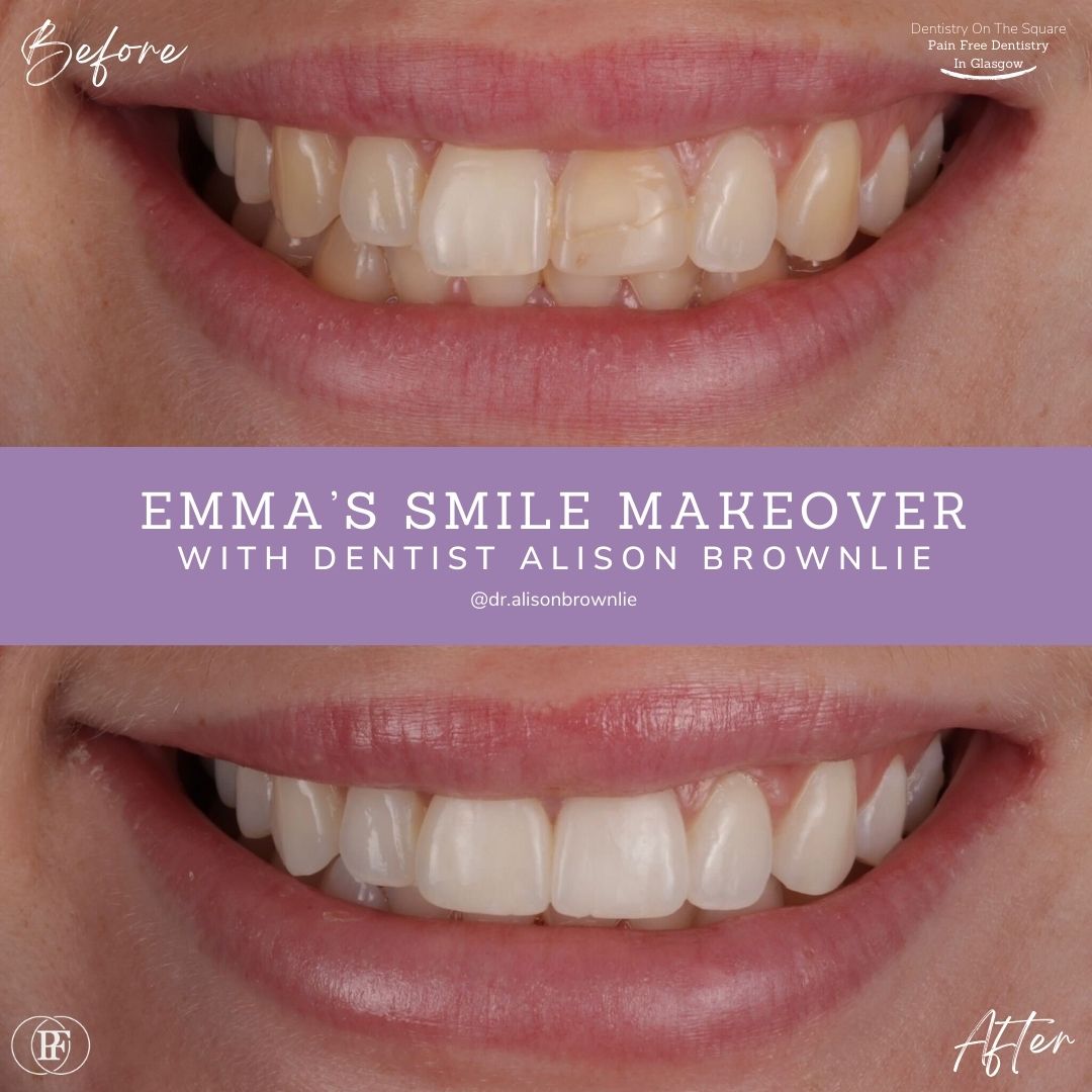Emma's Smile Story with Alison Brownlie (1)