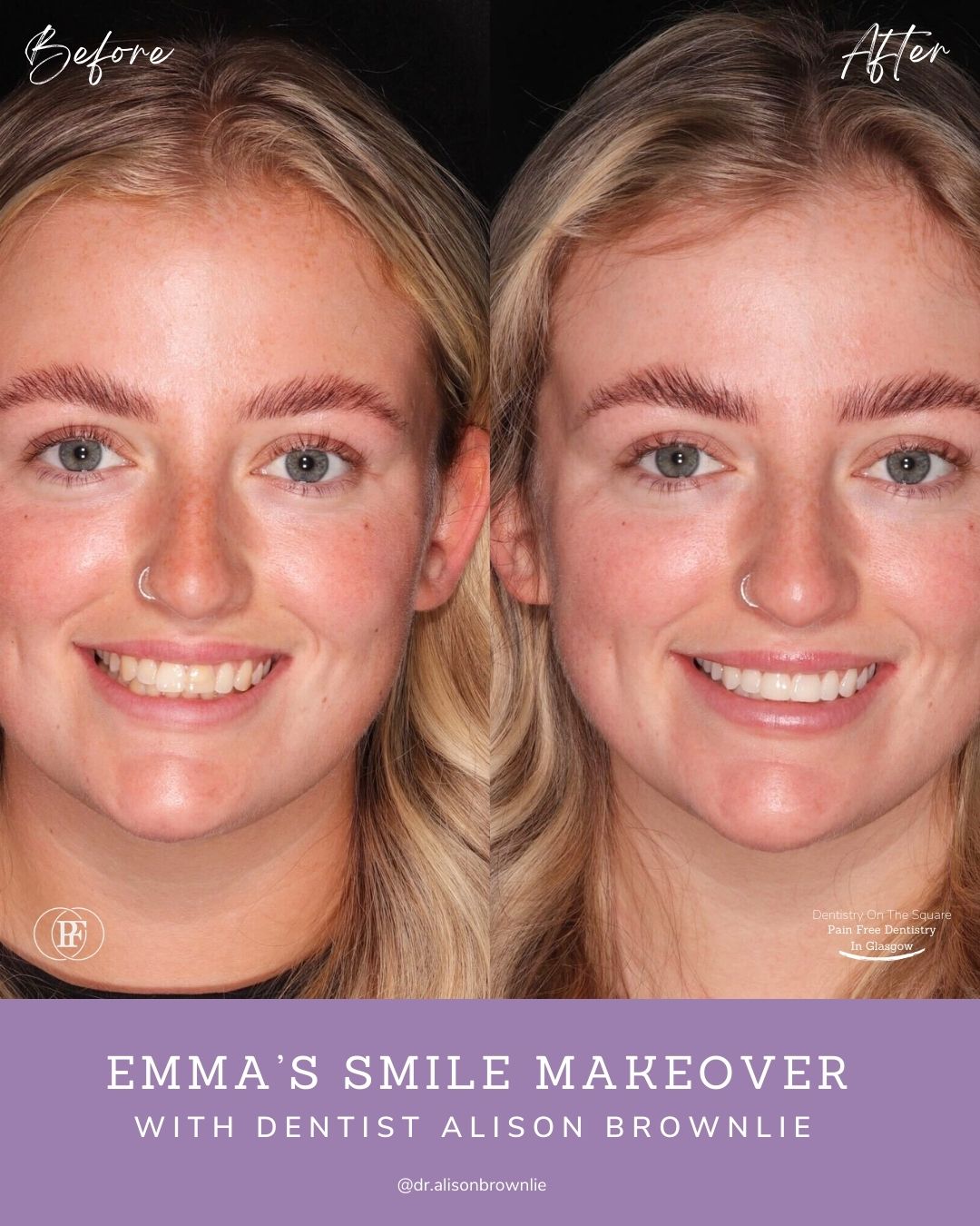 Dentistry On The Square, Pain Free Dentist Glasgow - Patient Stories