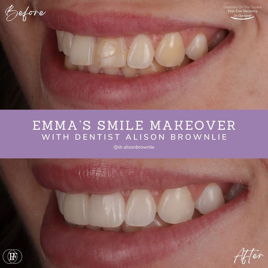 Emma's Smile Story with Alison Brownlie (1)
