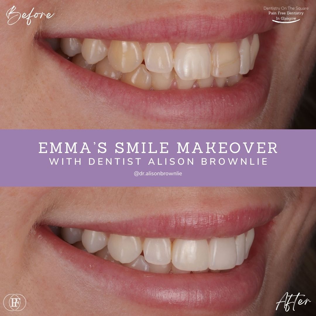 Emma's Smile Story with Alison Brownlie (1)