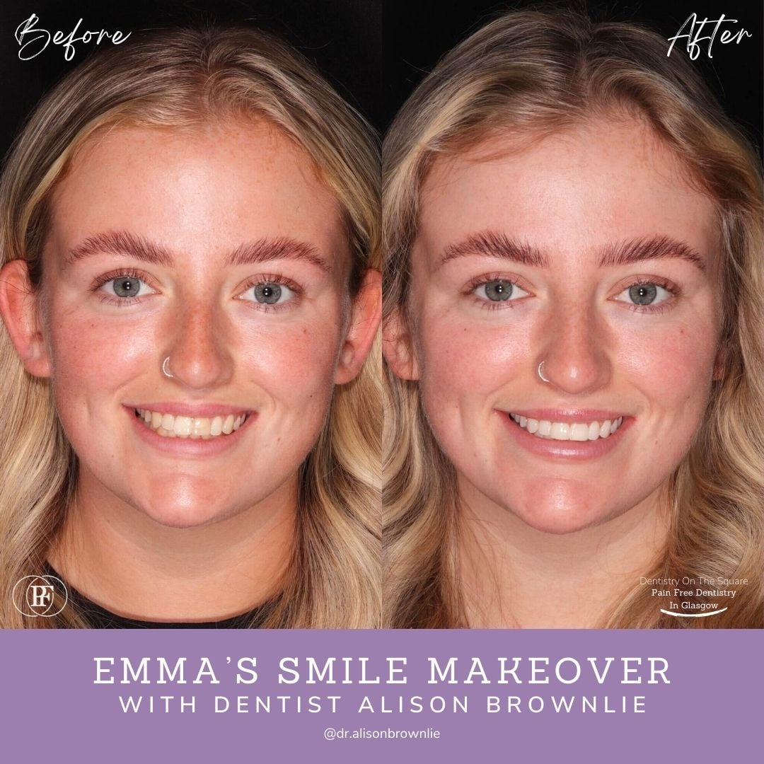 Emma's Smile Story with Alison Brownlie