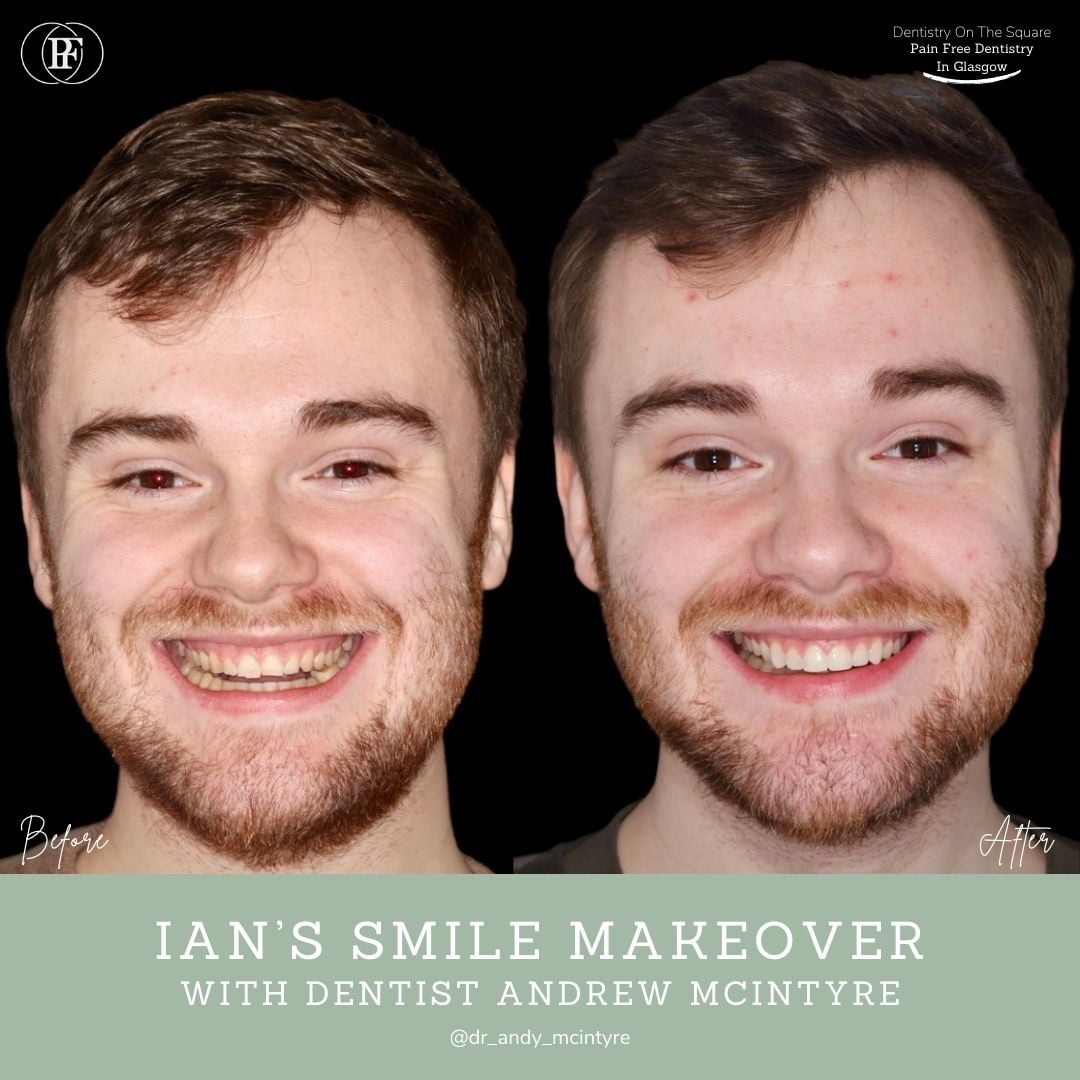 Ian's Smile Story With Andy DOTS (2)