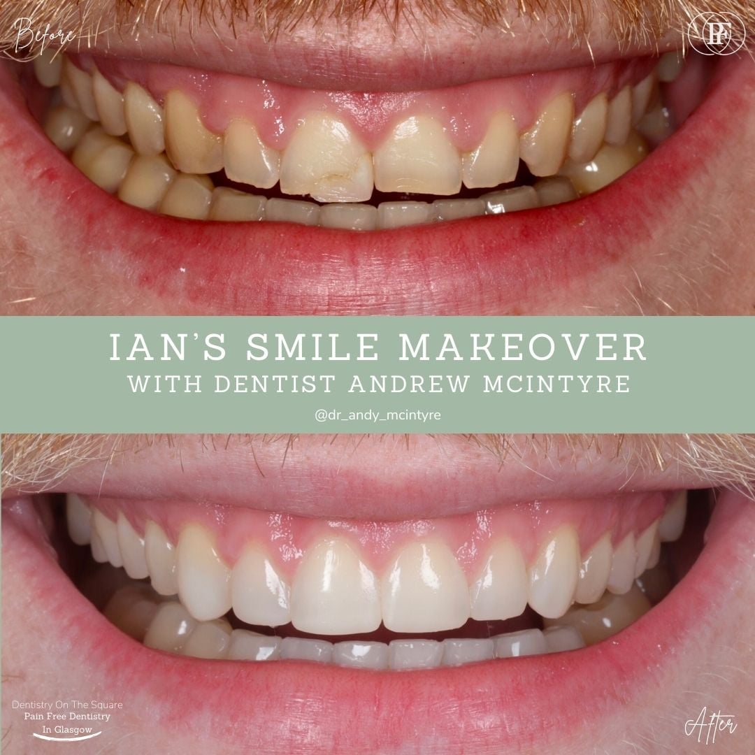 Ian's Smile Story With Andy DOTS (3)