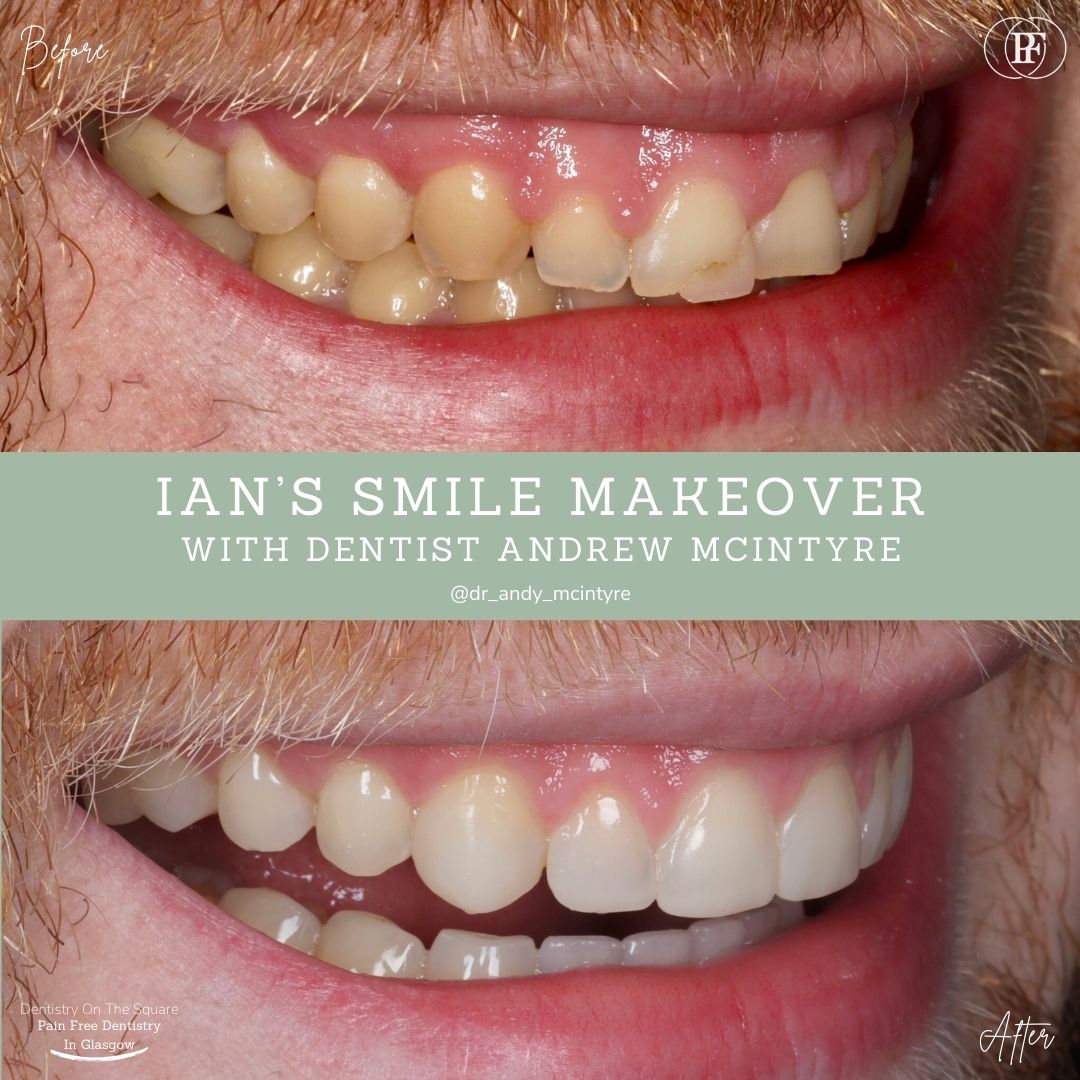 Ian's Smile Story With Andy DOTS (4)