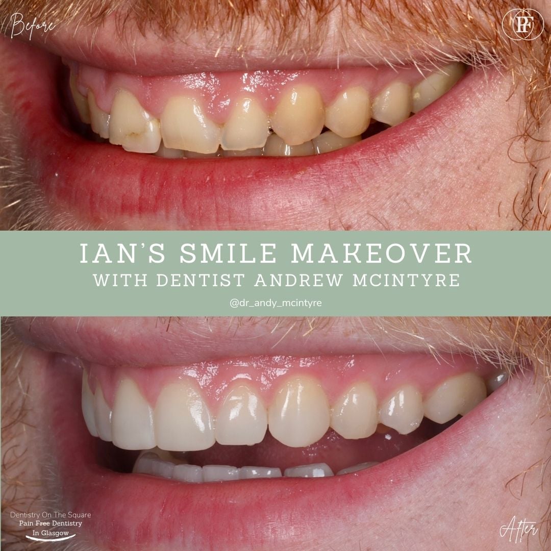 Ian's Smile Story With Andy DOTS (5)