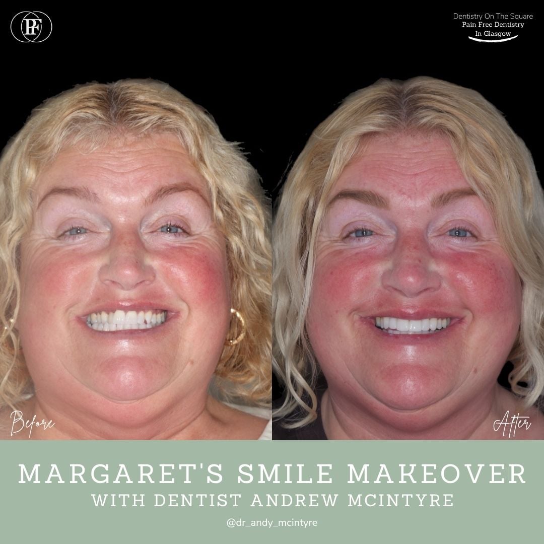 Dentistry On The Square, Pain Free Dentist Glasgow - Margaret's Smile Story Ross's smile story