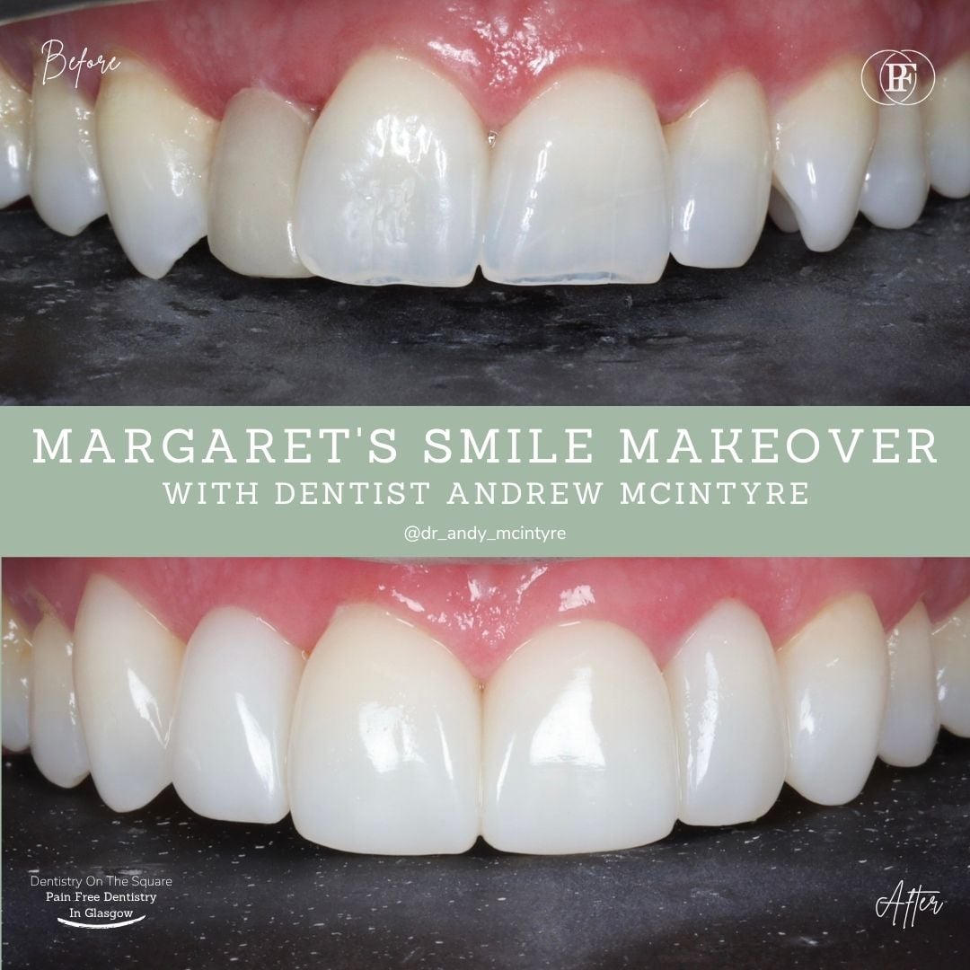 Margaret's Smile Story With Andy DOTS 