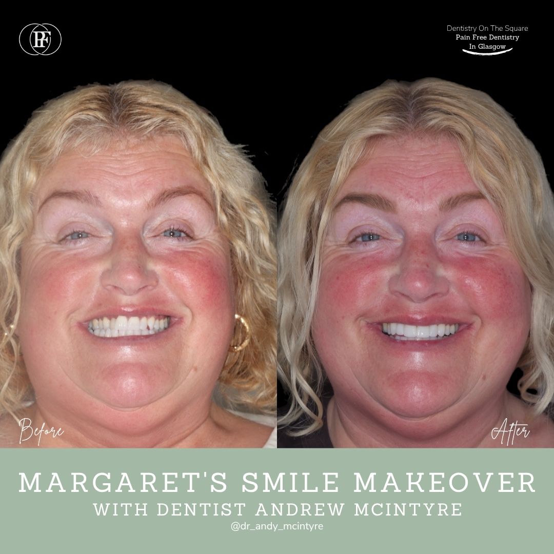 Margaret's Smile Story With Andy DOTS 