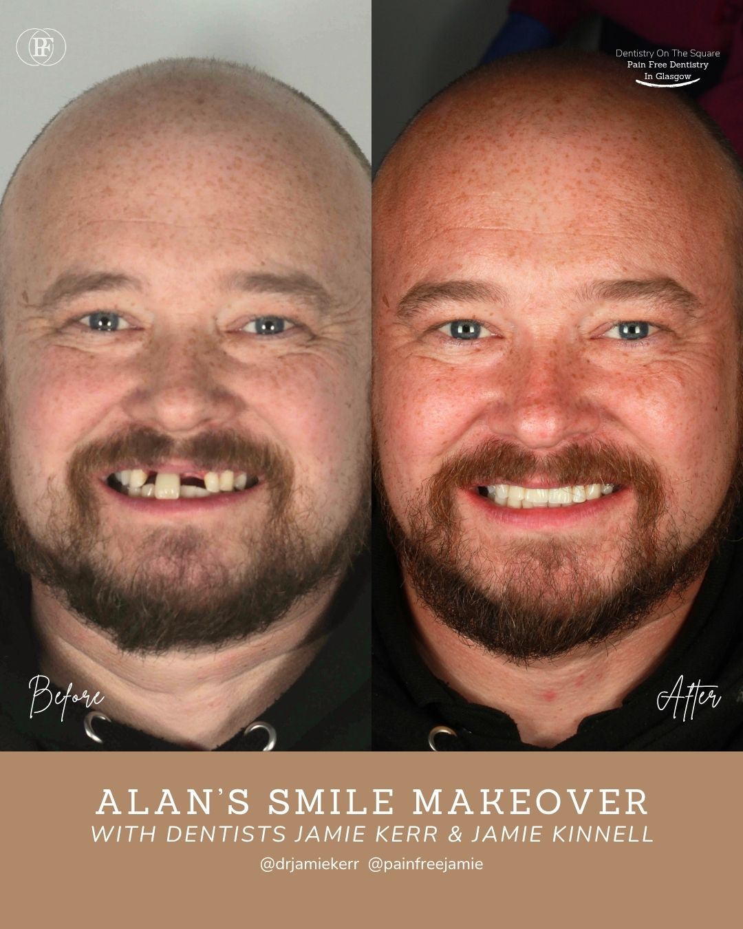 Alan S Smile Story With Jamie Kerr And Jamie Kinnell