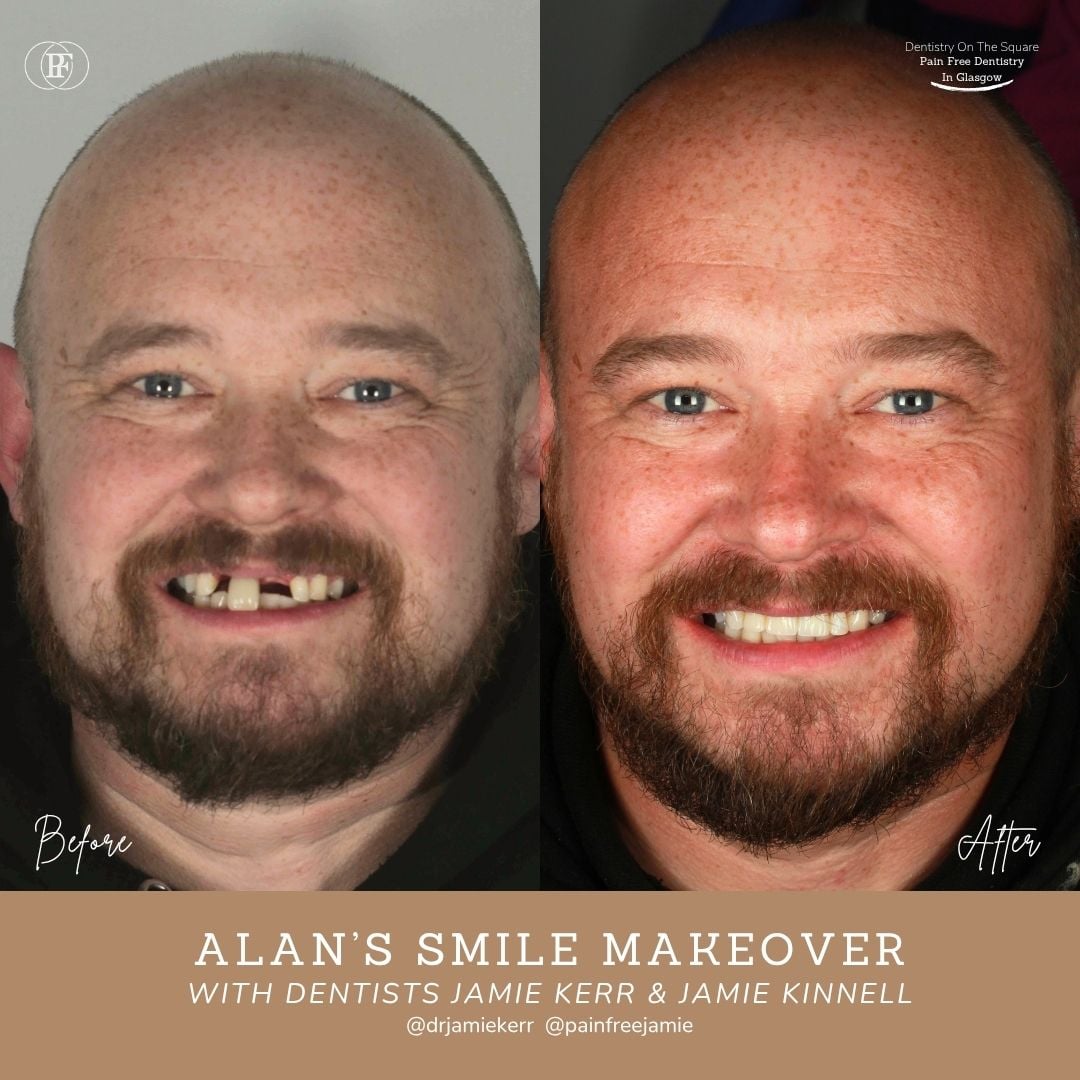 Alan's Smile Story With Jamie Kerr And Jamie Kinnell X Px