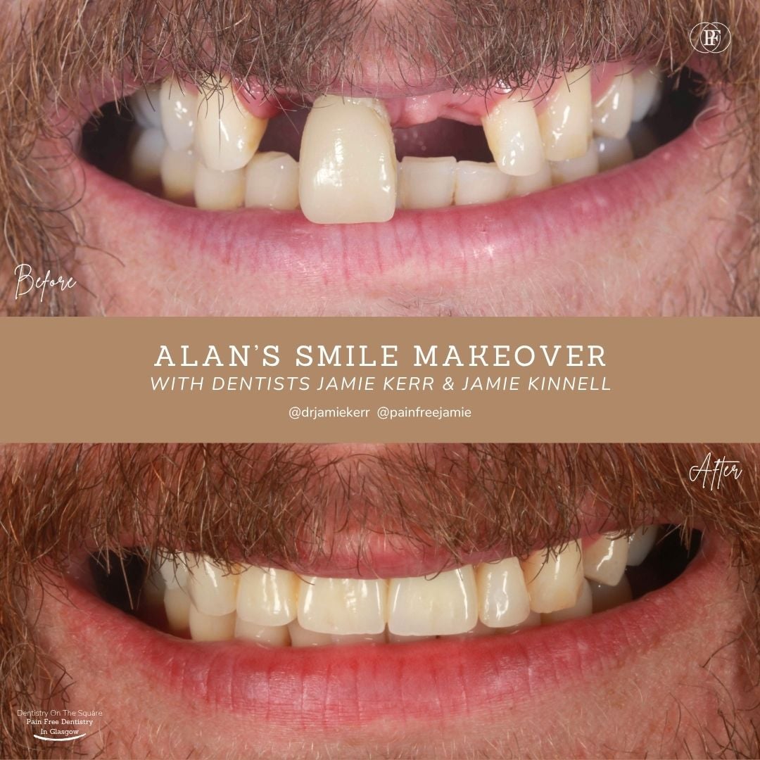 Alan's Smile Story With Jamie Kerr And Jamie Kinnell X Px