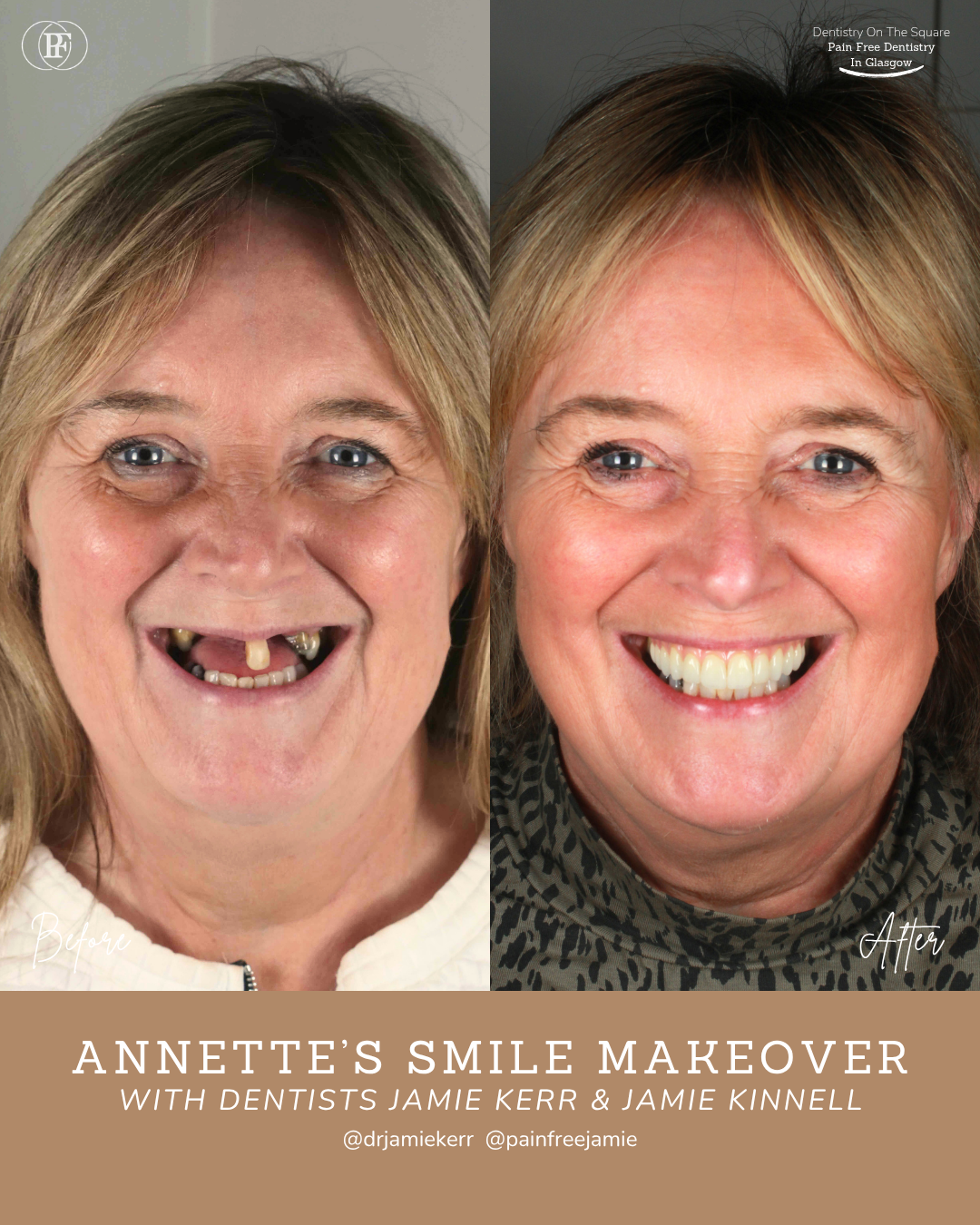 Annette S Smile Story With Jamie Kerr And Jamie Kinnell